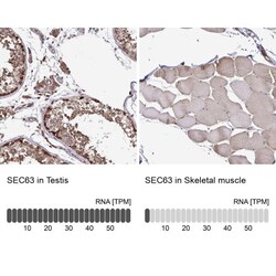 SEC63 Antibody, Novus Biologicals:Antibodies:Primary Antibodies